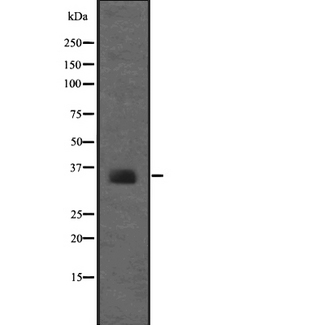 RPSA / Laminin Receptor Antibody - Western blot analysis of 67kDa Laminin Receptor using COS7 whole lysates.