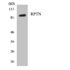 RPTN / Repetin Antibody - Western blot analysis of the lysates from HepG2 cells using RPTN antibody.