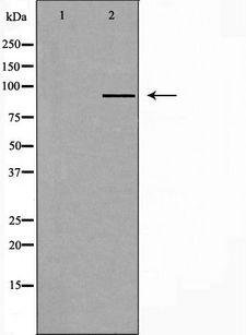 RPTN / Repetin Antibody - Western blot analysis of extracts of HeLa cells using RPTN antibody. The lane on the left is treated with the antigen-specific peptide.