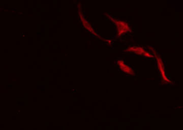 RPTN / Repetin Antibody - Staining HeLa cells by IF/ICC. The samples were fixed with PFA and permeabilized in 0.1% Triton X-100, then blocked in 10% serum for 45 min at 25°C. The primary antibody was diluted at 1:200 and incubated with the sample for 1 hour at 37°C. An Alexa Fluor 594 conjugated goat anti-rabbit IgG (H+L) antibody, diluted at 1/600, was used as secondary antibody.