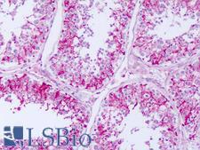 RPTN / Repetin Antibody - Anti-RPTN / Repetin antibody IHC of human testis. Immunohistochemistry of formalin-fixed, paraffin-embedded tissue after heat-induced antigen retrieval. Antibody dilution 5-10 ug/ml. This image was taken for the unconjugated form of this product. Other forms have not been tested.