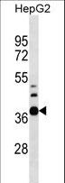 RPUSD1 Antibody - RPUSD1 Antibody western blot of HepG2 cell line lysates (35 ug/lane). The RPUSD1 antibody detected the RPUSD1 protein (arrow).