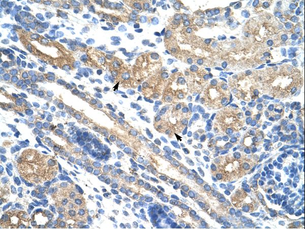RPUSD2 Antibody - RPUSD2 antibody ARP41140_T100-NP_689473-RPUSD2 (RNA pseudouridylate synthase domain containing 2) Antibody was used in IHC to stain formalin-fixed, paraffin-embedded human kidney.  This image was taken for the unconjugated form of this product. Other forms have not been tested.