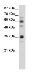 RPUSD2 Antibody - HepG2 Cell Lysate.  This image was taken for the unconjugated form of this product. Other forms have not been tested.