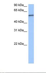 RPUSD2 Antibody - Jurkat cell lysate. Antibody concentration: 0.5 ug/ml. Gel concentration: 12%.  This image was taken for the unconjugated form of this product. Other forms have not been tested.