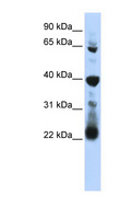 RPUSD3 Antibody - RPUSD3 antibody Western blot of 721_B cell lysate. This image was taken for the unconjugated form of this product. Other forms have not been tested.