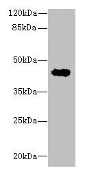 RPUSD4 Antibody - Western blot All lanes: RPUSD4 antibody at 0.5µg/ml + MCF-7 whole cell lysate Secondary Goat polyclonal to rabbit IgG at 1/10000 dilution Predicted band size: 43, 39 kDa Observed band size: 43 kDa