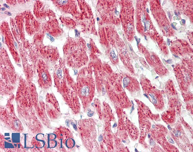 RRAD Antibody - Human Heart: Formalin-Fixed, Paraffin-Embedded (FFPE).  This image was taken for the unconjugated form of this product. Other forms have not been tested.