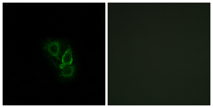 RRAD Antibody - Immunofluorescence analysis of A549 cells, using RAD Antibody. The picture on the right is blocked with the synthesized peptide.