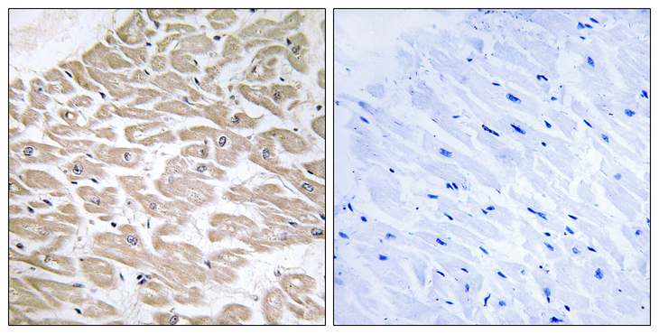 RRAD Antibody - Immunohistochemistry analysis of paraffin-embedded human heart tissue, using RAD Antibody. The picture on the right is blocked with the synthesized peptide.