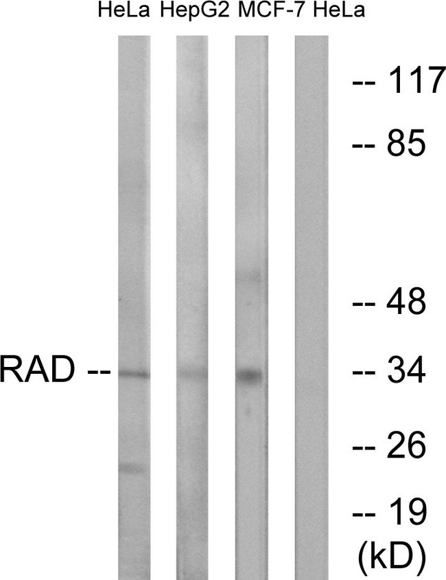 RRAD Antibody - Western blot analysis of lysates from HeLa and HepG2/MCF-7 cells, using RAD Antibody. The lane on the right is blocked with the synthesized peptide.