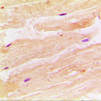 RRAD Antibody - Immunohistochemical analysis of RRAD staining in human muscle formalin fixed paraffin embedded tissue section. The section was pre-treated using heat mediated antigen retrieval with sodium citrate buffer (pH 6.0). The section was then incubated with the antibody at room temperature and detected using an HRP conjugated compact polymer system. DAB was used as the chromogen. The section was then counterstained with hematoxylin and mounted with DPX.