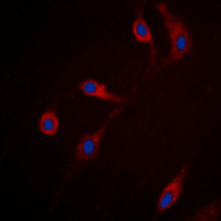 RRAD Antibody - Immunofluorescent analysis of RRAD staining in HepG2 cells. Formalin-fixed cells were permeabilized with 0.1% Triton X-100 in TBS for 5-10 minutes and blocked with 3% BSA-PBS for 30 minutes at room temperature. Cells were probed with the primary antibody in 3% BSA-PBS and incubated overnight at 4 C in a humidified chamber. Cells were washed with PBST and incubated with a DyLight 594-conjugated secondary antibody (red) in PBS at room temperature in the dark. DAPI was used to stain the cell nuclei (blue).