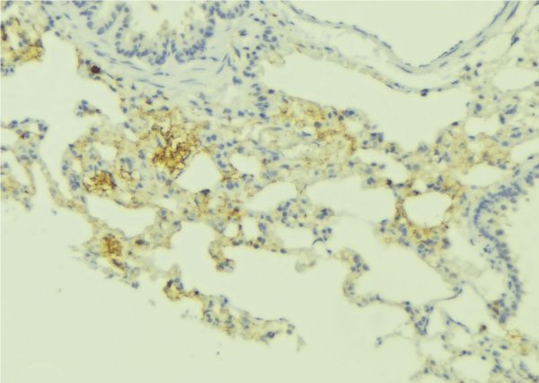 RRAD Antibody - 1:100 staining human lung tissue by IHC-P. The sample was formaldehyde fixed and a heat mediated antigen retrieval step in citrate buffer was performed. The sample was then blocked and incubated with the antibody for 1.5 hours at 22°C. An HRP conjugated goat anti-rabbit antibody was used as the secondary.