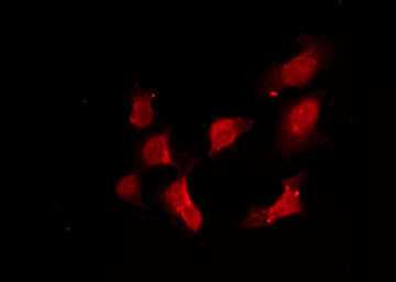 RRAD Antibody - Staining HeLa cells by IF/ICC. The samples were fixed with PFA and permeabilized in 0.1% Triton X-100, then blocked in 10% serum for 45 min at 25°C. The primary antibody was diluted at 1:200 and incubated with the sample for 1 hour at 37°C. An Alexa Fluor 594 conjugated goat anti-rabbit IgG (H+L) Ab, diluted at 1/600, was used as the secondary antibody.