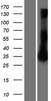 RRAD Protein - Western validation with an anti-DDK antibody * L: Control HEK293 lysate R: Over-expression lysate