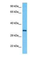 RRAGA Antibody - Western blot of RRAGA Antibody with human Fetal Lung lysate.  This image was taken for the unconjugated form of this product. Other forms have not been tested.