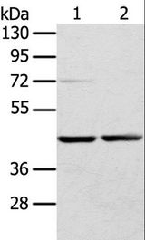 RRAGA Antibody - Western blot analysis of Hepg2 and HeLa cell, using RRAGA Polyclonal Antibody at dilution of 1:400.