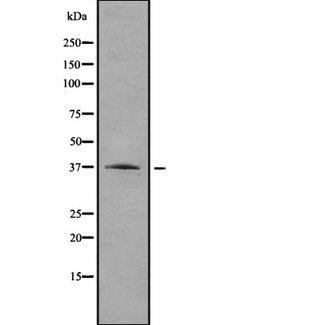 RRAGA Antibody - Western blot analysis of RRAGA using HepG2 whole lysates.