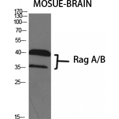 RRAGA+B Antibody - Western blot of Rag A/B antibody