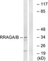 RRAGA+B Antibody - Western blot analysis of lysates from HepG2 cells, using RRAGA/B Antibody. The lane on the right is blocked with the synthesized peptide.