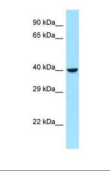RRAGB / RAGB Antibody - Western blot of Human PANC1. RRAGB antibody dilution 1.0 ug/ml.  This image was taken for the unconjugated form of this product. Other forms have not been tested.