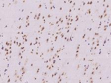 RRAGB / RAGB Antibody - Immunochemical staining of human RRAGB in human brain with rabbit polyclonal antibody at 1:500 dilution, formalin-fixed paraffin embedded sections.