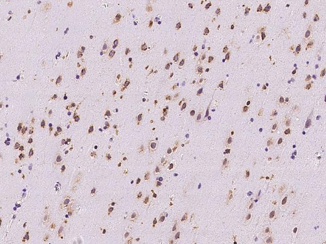 RRAGB / RAGB Antibody - Immunochemical staining of human RRAGB in human brain with rabbit polyclonal antibody at 1:500 dilution, formalin-fixed paraffin embedded sections.
