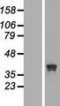 RRAGB / RAGB Protein - Western validation with an anti-DDK antibody * L: Control HEK293 lysate R: Over-expression lysate