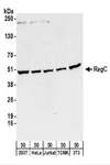 RRAGC / RAGC Antibody - Detection of Human and Mouse RagC by Western Blot. Samples: Whole cell lysate (50 ug) from 293T, HeLa, Jurkat, mouse TCMK-1, and mouse NIH3T3 cells. Antibodies: Affinity purified rabbit anti-RagC antibody used for WB at 0.1 ug/ml. Detection: Chemiluminescence with an exposure time of 3 minutes.