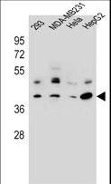 RRAGC / RAGC Antibody - RRAGC Antibody western blot of 293,MDA-MB231,HeLa,HepG2 cell line lysates (35 ug/lane). The RRAGC antibody detected the RRAGC protein (arrow).