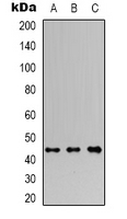 RRAGC / RAGC Antibody - Western blot analysis of RagC expression in Jurkat (A); A549 (B); HEK293T (C) whole cell lysates.