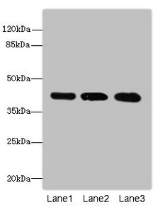 RRAGC / RAGC Antibody - Western blot All Lanes: RRAGCantibody at 1.14ug/ml Lane 1 : Hela whole cell lysate Lane 2 : MCF7 whole cell lysate Lane 3 : A549 whole cell lysate Secondary Goat polyclonal to Rabbit IgG at 1/10000 dilution Predicted band size: 44 kDa Observed band size: 44 kDa