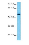 RRAGC / RAGC Antibody - Western blot of RRAGC Antibody with human Thymus Tumor lysate.  This image was taken for the unconjugated form of this product. Other forms have not been tested.