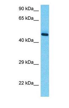 RRAGC / RAGC Antibody - Western blot of RRAGC Antibody with human Thymus Tumor lysate.  This image was taken for the unconjugated form of this product. Other forms have not been tested.