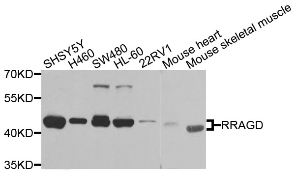 RRAGD Antibody - Western blot analysis of extracts of various cells.