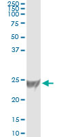 RRAS Antibody - Immunoprecipitation of RRAS transfected lysate using anti-RRAS monoclonal antibody and Protein A Magnetic Bead, and immunoblotted with RRAS rabbit polyclonal antibody.