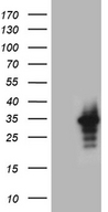 RRAS Antibody - HEK293T cells were transfected with the pCMV6-ENTRY control. (Left lane) or pCMV6-ENTRY RRAS. (Right lane) cDNA for 48 hrs and lysed. Equivalent amounts of cell lysates. (5 ug per lane) were separated by SDS-PAGE and immunoblotted with anti-RRAS. (1:2000)