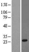 RRAS Protein - Western validation with an anti-DDK antibody * L: Control HEK293 lysate R: Over-expression lysate