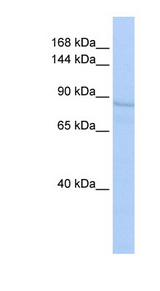 RRBP1 / hES Antibody - RRBP1 antibody Western blot of HepG2 cell lysate. This image was taken for the unconjugated form of this product. Other forms have not been tested.