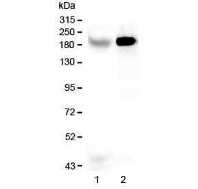 RRBP1 / hES Antibody - Western blot testing of human 1) Caco-2 and 2) HepG2 lysate with RRBP1 antibody at 0.5ug/ml. Expected molecular weight ~180 kDa.