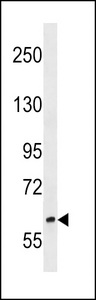 RREB1 Antibody - RREB1 Antibody western blot of NCI-H460 cell line lysates (35 ug/lane). The RREB1 antibody detected the RREB1 protein (arrow).