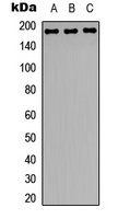 RREB1 Antibody - Western blot analysis of Zep-1 expression in HeLa (A); NIH3T3 (B); rat brain (C) whole cell lysates.