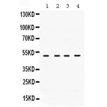 RRM2 Antibody - RRM2 antibody Western blot. All lanes: Anti RRM2 at 0.5 ug/ml. Lane 1: Rat Cardiac Muscle Tissue Lysate at 50 ug. Lane 2: Mouse Cardiac Muscle Tissue Lysate at 50 ug. Lane 3: A431 Whole Cell Lysate at 40 ug. Lane 4: HELA Whole Cell Lysate at 40 ug. Predicted band size: 50 kD. Observed band size: 50 kD.
