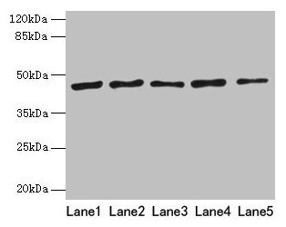 RRM2 Antibody - Western blot All lanes: Ribonucleoside-diphosphate reductase subunit M2 antibody at 8µg/ml Lane 1: HepG2 whole cell lysate Lane 2: Jurkat whole cell lysate Lane 3: Hela whole cell lysate Lane 4: K562 whole cell lysate Lane 5: 293T whole cell lysate Secondary Goat polyclonal to rabbit IgG at 1/10000 dilution Predicted band size: 45, 52 kDa Observed band size: 45 kDa
