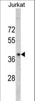 RRM2 Antibody - Western blot of RRM2 antibody in Jurkat cell line lysates (35 ug/lane). RRM2 (arrow) was detected using the purified antibody.
