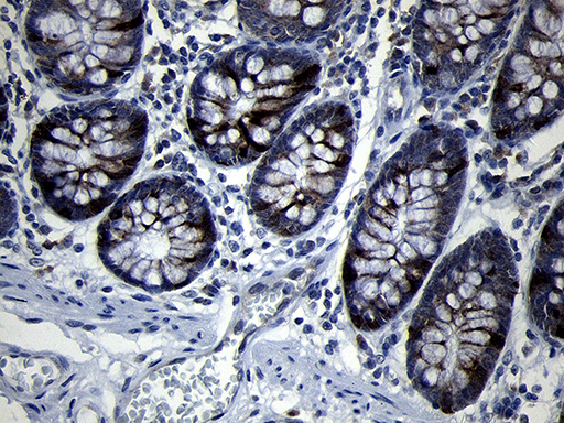 RRM2 Antibody - Immunohistochemical staining of paraffin-embedded Human colon tissue within the normal limits using anti-RRM2 mouse monoclonal antibody. (Heat-induced epitope retrieval by 1mM EDTA in 10mM Tris buffer. (pH8.5) at 120°C for 3 min. (1:2000)