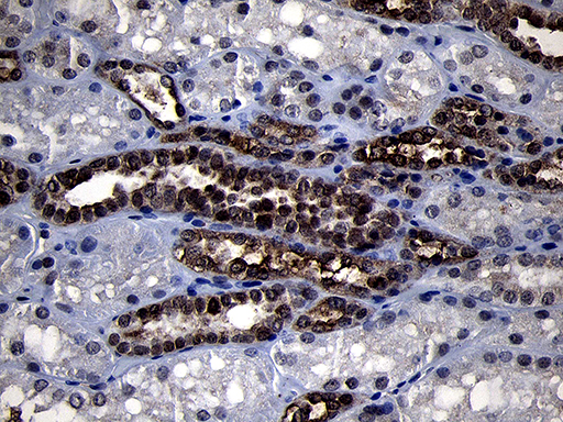 RRM2 Antibody - Immunohistochemical staining of paraffin-embedded Human Kidney tissue within the normal limits using anti-RRM2 mouse monoclonal antibody. (Heat-induced epitope retrieval by 1mM EDTA in 10mM Tris buffer. (pH8.5) at 120°C for 3 min. (1:2000)