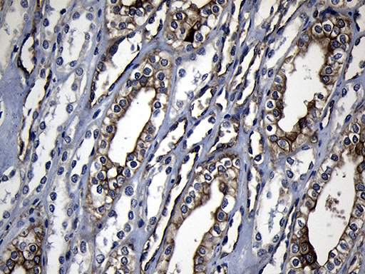 RRM2 Antibody - Immunohistochemical staining of paraffin-embedded Human Kidney tissue within the normal limits using anti-RRM2 mouse monoclonal antibody. (Heat-induced epitope retrieval by 1mM EDTA in 10mM Tris buffer. (pH8.5) at 120°C for 3 min. (1:150)