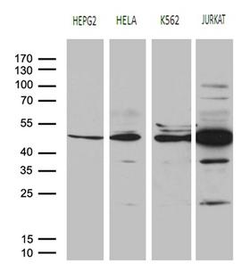 RRM2 Antibody - Western blot analysis of extracts. (35ug) from 4 different cell lines by using anti-RRM2 monoclonal antibody. (1:500)